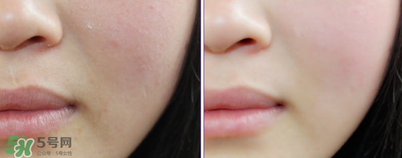 伽優(yōu)氣墊多少錢(qián)？伽優(yōu)氣墊適合什么年齡？