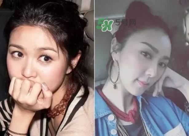 發(fā)際線低怎么調(diào)整？標(biāo)準(zhǔn)的發(fā)際線圖片