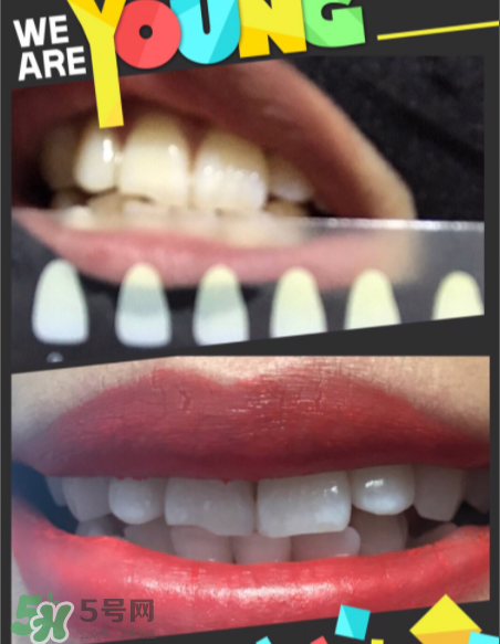 碧緹福美牙儀有副作用嗎？碧緹福美牙儀副作用是什么？