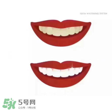 美牙儀能帶上飛機(jī)嗎？美牙儀可以過安檢嗎？