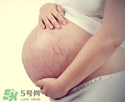 孕婦胸部長妊娠紋嗎？胸部長妊娠紋了怎么辦？