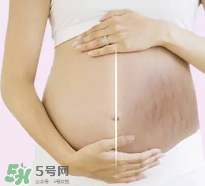 長(zhǎng)妊娠紋的前兆 長(zhǎng)妊娠紋很癢怎么辦？