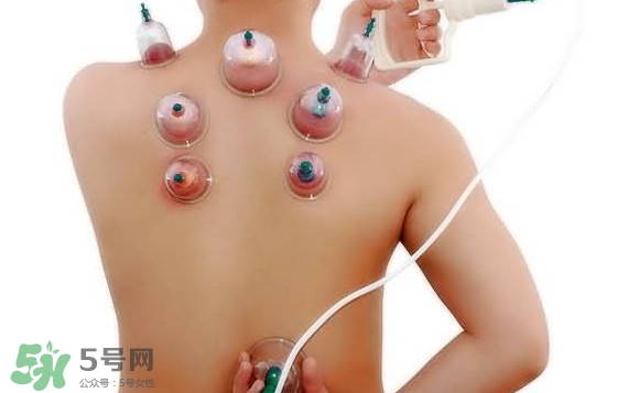 火罐和真空罐哪個(gè)好？真空罐和火罐效果一樣好嗎