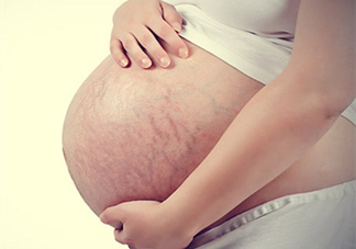 孕婦胸部長(zhǎng)妊娠紋嗎？胸部長(zhǎng)妊娠紋了怎么辦？