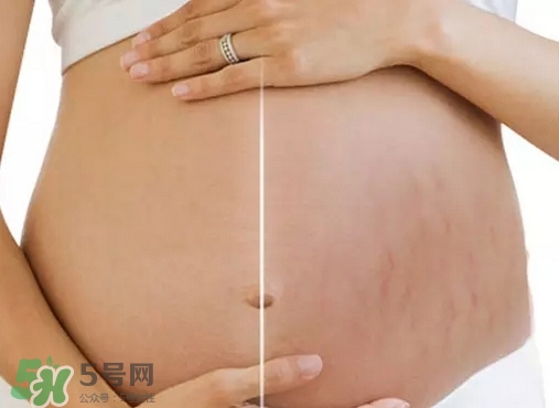 脖子上會長妊娠紋嗎？妊娠紋長在哪些地方？