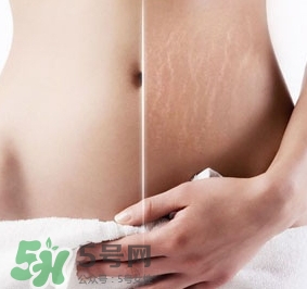 妊娠紋什么時候變白？妊娠紋產(chǎn)品什么時候用？