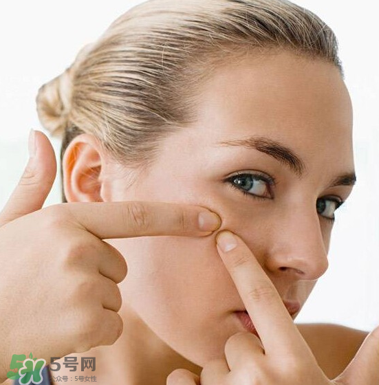 長痘長閉口怎么辦？長痘長閉口是什么原因？