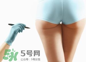 吸脂減肥副作用有哪些？吸脂減肥可靠嗎？