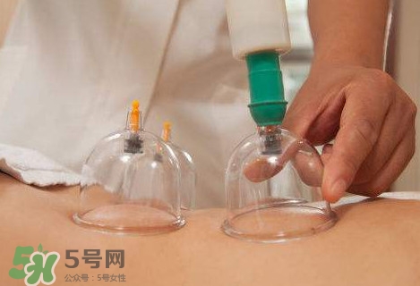 真空拔罐有用嗎？真空拔罐多長(zhǎng)時(shí)間合適