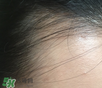 發(fā)際線粉要卸妝嗎_怎么卸？