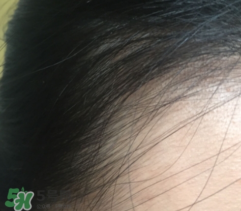 發(fā)際線粉要卸妝嗎_怎么卸？