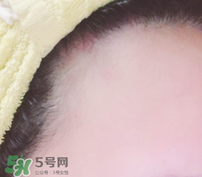 發(fā)際線粉哪個牌子好？