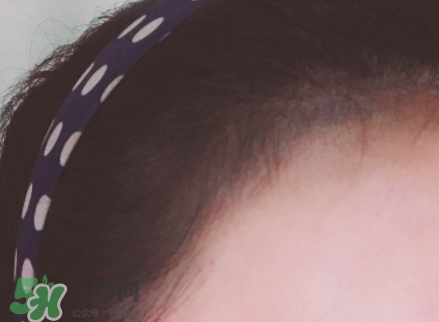 發(fā)際線粉哪個牌子好？