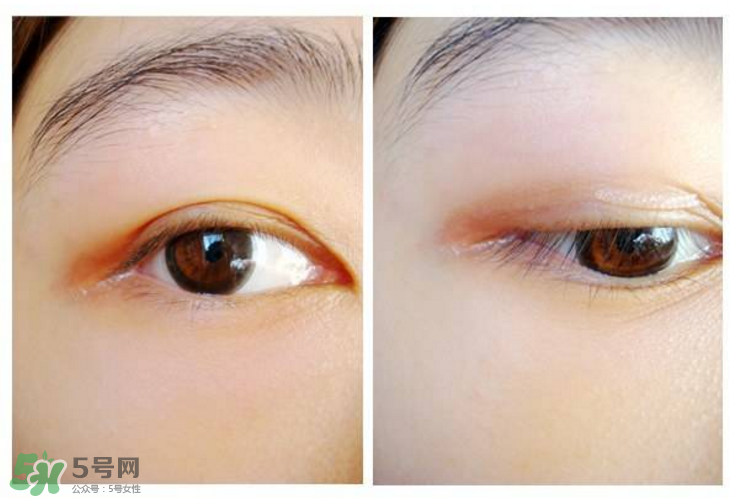 網(wǎng)紅雙眼皮貼大推薦？雙眼皮貼正確貼法