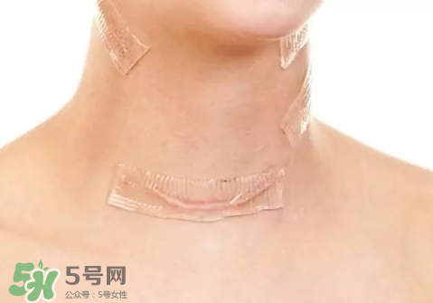 硅膠疤痕貼有用嗎？硅膠疤痕貼效果怎么樣？