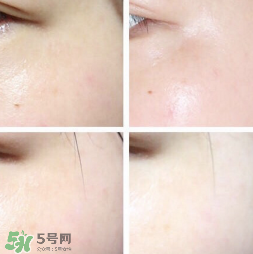 城野醫(yī)生377孕婦可以用嗎？城野醫(yī)生377孕婦用好嗎？