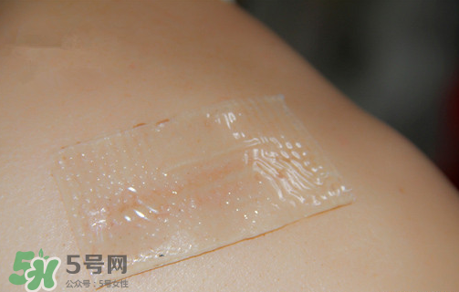 仙卡疤痕貼有用嗎？仙卡疤痕貼效果怎么樣？