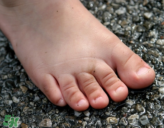 日本灰指甲藥水有用嗎？日本灰指甲藥水評(píng)測(cè)