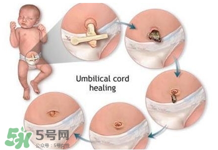 寶寶臍帶什么時(shí)候脫落？寶寶臍帶脫落后怎么護(hù)理？