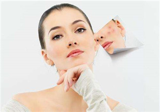 祛痘產(chǎn)品哪種效果最好？祛痘產(chǎn)品推薦