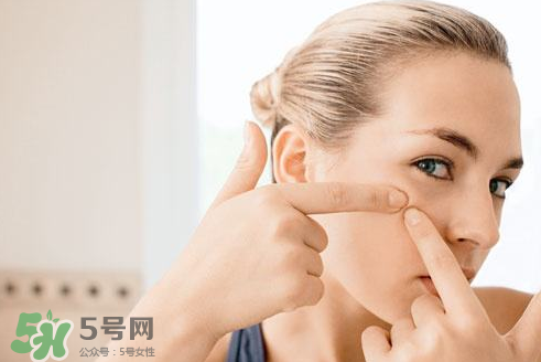 暗瘡可以擠壓嗎？油性和骯臟肌膚會(huì)容易有暗瘡嗎？