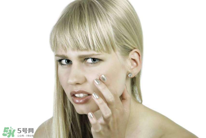 痤瘡和毛囊炎一樣嗎？痤瘡與毛囊炎區(qū)別