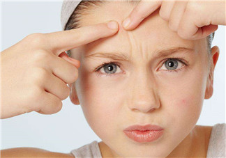 暗瘡可以擠壓嗎？油性和骯臟肌膚會容易有暗瘡嗎？