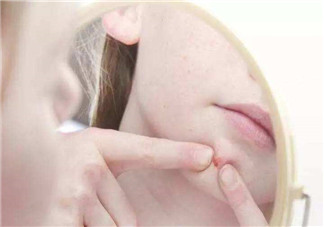 痤瘡和毛囊炎一樣嗎？痤瘡與毛囊炎區(qū)別