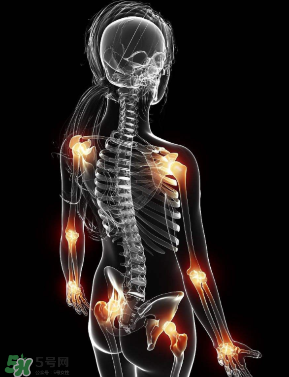 風濕要忌口嗎？風濕飲食禁忌