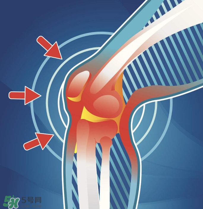 風濕要忌口嗎？風濕飲食禁忌