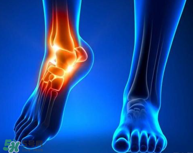 風濕要忌口嗎？風濕飲食禁忌