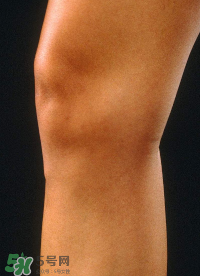 風濕要做哪些檢查？風濕要檢查哪些項目？