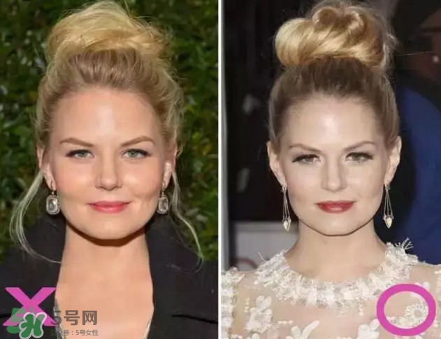 新打耳洞戴什么材質(zhì)的耳釘好？打耳洞用什么消毒最好