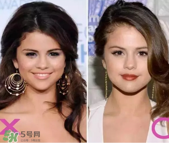 新打耳洞戴什么材質(zhì)的耳釘好？打耳洞用什么消毒最好