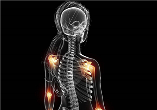 風(fēng)濕要忌口嗎？風(fēng)濕飲食禁忌