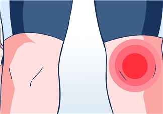 風(fēng)濕可以泡腳嗎？風(fēng)濕可以泡溫泉嗎？