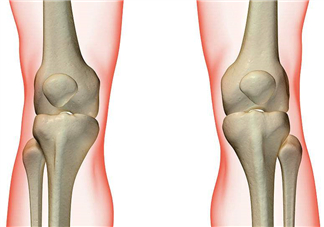 風(fēng)濕不治療可以治愈嗎？早期風(fēng)濕能自愈嗎？