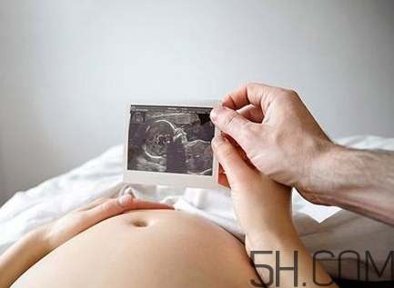 羊水過少能順產嗎？羊水過少的原因 