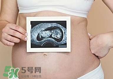 雙子宮可以上環(huán)嗎？雙子宮上環(huán)要注意哪些？