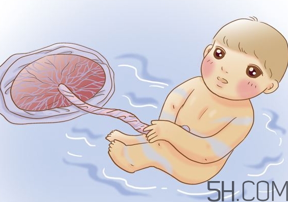 羊水過少能順產嗎？羊水過少的原因 