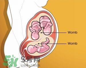 雙子宮是什么意思？雙子宮可以順產(chǎn)嗎？