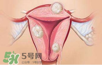 雙子宮可以上環(huán)嗎？雙子宮上環(huán)要注意哪些？