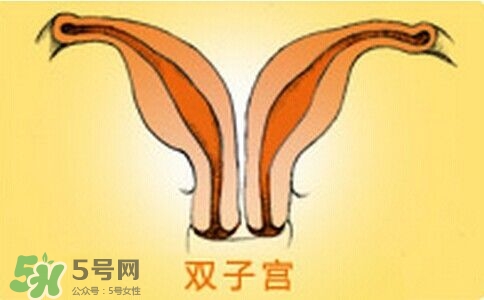 雙子宮是什么意思？雙子宮可以順產(chǎn)嗎？