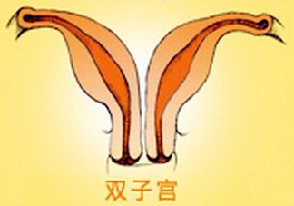 雙子宮是什么意思？雙子宮可以順產(chǎn)嗎？