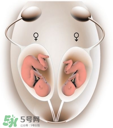 雙子宮對懷孕有影響嗎？雙子宮懷孕要注意什么？