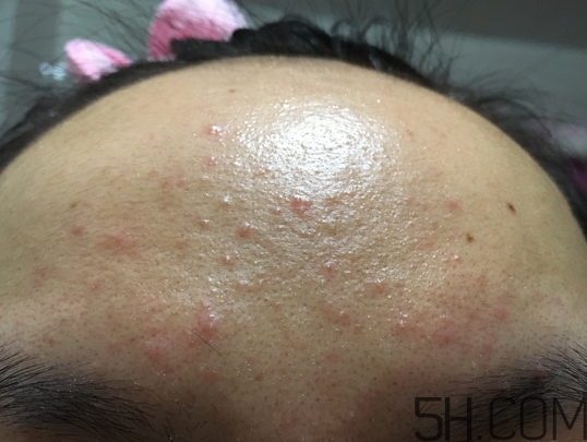 nyr金盞花膏怎么樣_nyr金盞花膏好用嗎 nyr金盞花膏怎么樣_nyr金盞花膏好用嗎