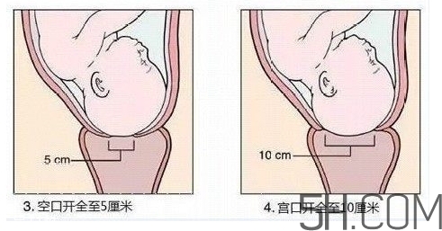 內(nèi)檢是什么感覺(jué)？?jī)?nèi)檢有男醫(yī)生嗎？