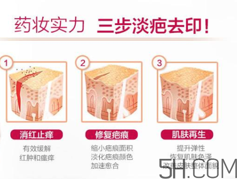 ISDIN怡思丁祛疤膏怎么用？ISDIN怡思丁祛疤膏使用說明