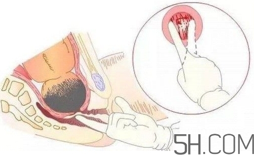 內(nèi)檢是什么感覺(jué)？?jī)?nèi)檢有男醫(yī)生嗎？