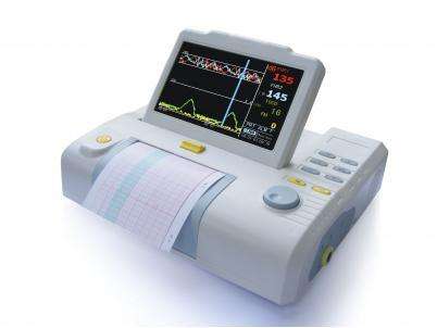 胎心監(jiān)護圖怎么看？胎心監(jiān)護多少錢？